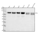 Anti-Cortactin CTTN Rabbit Monoclonal Antibody Boster Bio
