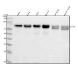 Anti-Cortactin CTTN Rabbit Monoclonal Antibody Boster Bio