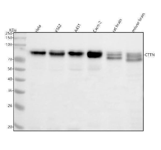 Anti-Cortactin CTTN Rabbit Monoclonal Antibody Boster Bio