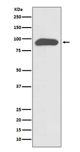 Anti-Chromogranin A CHGA Rabbit Monoclonal Antibody Boster Bio
