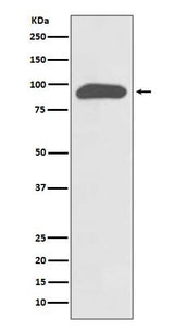 Anti-Chromogranin A CHGA Rabbit Monoclonal Antibody Boster Bio