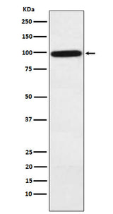 Anti-Complement factor B Rabbit Monoclonal Antibody Boster Bio