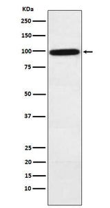 Anti-Complement factor B Rabbit Monoclonal Antibody Boster Bio