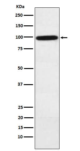 Anti-Complement factor B Rabbit Monoclonal Antibody Boster Bio