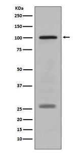 Anti-PMEL17 / GP100 Rabbit Monoclonal Antibody Boster Bio