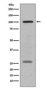 Anti-PMEL17 / GP100 Rabbit Monoclonal Antibody Boster Bio