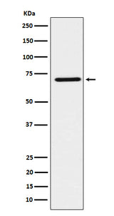 Anti-HNF1 beta Rabbit Monoclonal Antibody Boster Bio
