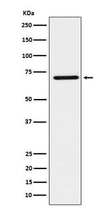 Anti-HNF1 beta Rabbit Monoclonal Antibody Boster Bio