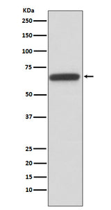 Anti-HNF1 beta Rabbit Monoclonal Antibody Boster Bio