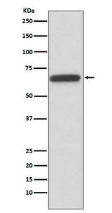 Anti-HNF1 beta Rabbit Monoclonal Antibody Boster Bio