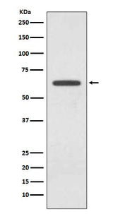 Anti-Glutaminase GLS Rabbit Monoclonal Antibody Boster Bio