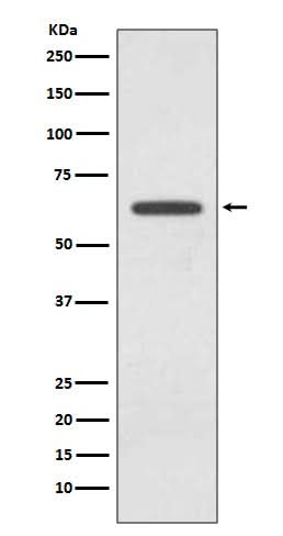 Anti-Glutaminase GLS Rabbit Monoclonal Antibody Boster Bio