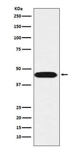 Anti-LIS1 Rabbit Monoclonal Antibody Boster Bio