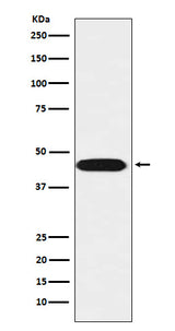Anti-LIS1 Rabbit Monoclonal Antibody Boster Bio