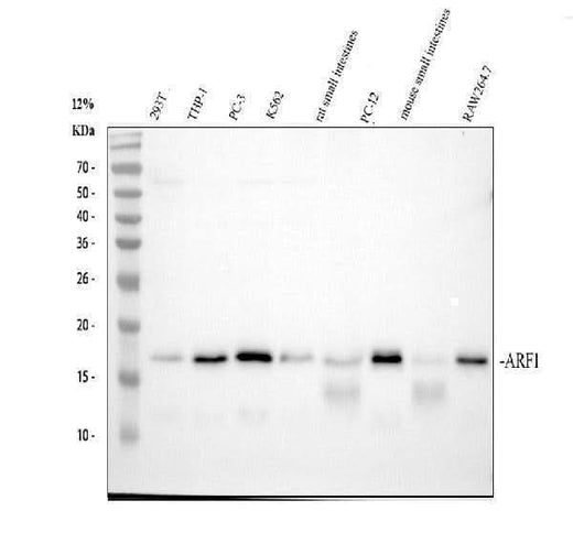 Anti-ARF1 Rabbit Monoclonal Antibody Boster Bio