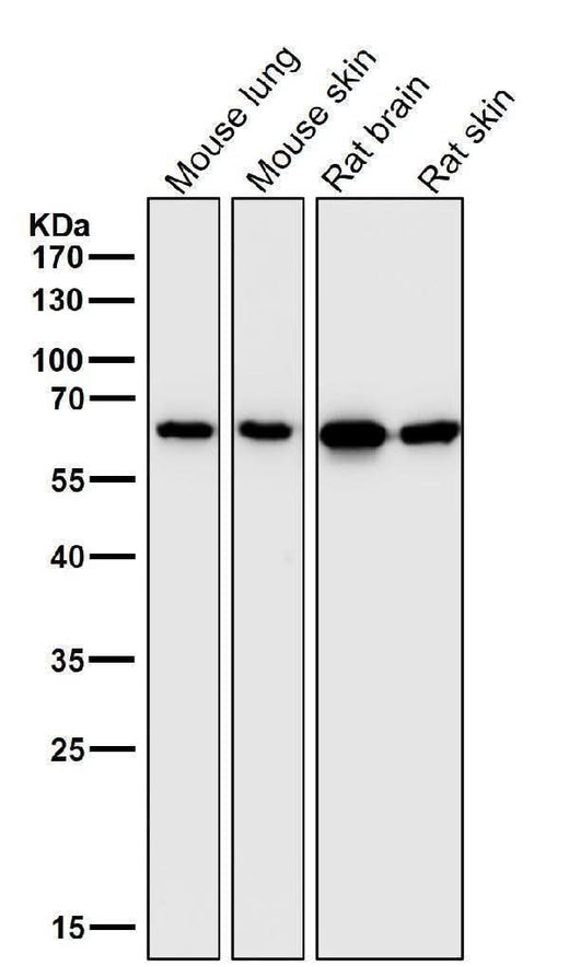 Anti-Hsp60 HSPD1 Rabbit Monoclonal Antibody Boster Bio