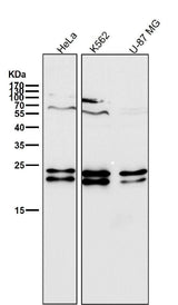 Anti-CD81 Rabbit Monoclonal Antibody Boster Bio