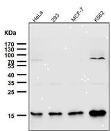 Anti-Sumo2/3 Rabbit Monoclonal Antibody Boster Bio
