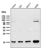 Anti-Sumo2/3 Rabbit Monoclonal Antibody Boster Bio