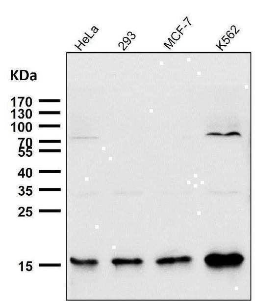 Anti-Sumo2/3 Rabbit Monoclonal Antibody Boster Bio