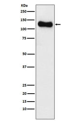 Anti-SAP97 Rabbit Monoclonal Antibody Boster Bio