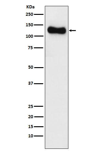 Anti-SAP97 Rabbit Monoclonal Antibody Boster Bio