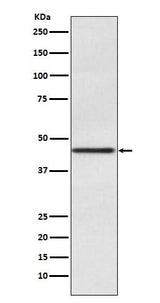 Anti-Pax2 Rabbit Monoclonal Antibody Boster Bio