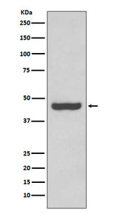 Anti-PAX2 Rabbit Monoclonal Antibody Boster Bio