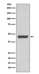 Anti-PAX2 Rabbit Monoclonal Antibody Boster Bio