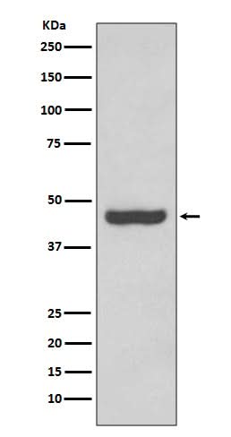 Anti-PAX2 Rabbit Monoclonal Antibody Boster Bio