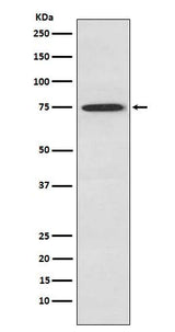 Anti-PKC theta Rabbit Monoclonal Antibody Boster Bio
