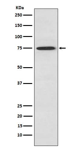 Anti-PKC theta Rabbit Monoclonal Antibody Boster Bio