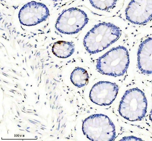 Anti-Somatostatin 28 Rabbit Monoclonal Antibody Boster Bio