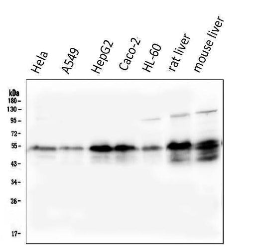 Anti-Retinoid X Receptor alpha/RXRA Antibody Picoband® (monoclonal, 5E7 Boster Bio
