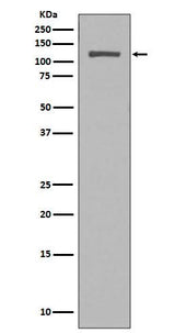 Anti-NUP98 Rabbit Monoclonal Antibody Boster Bio