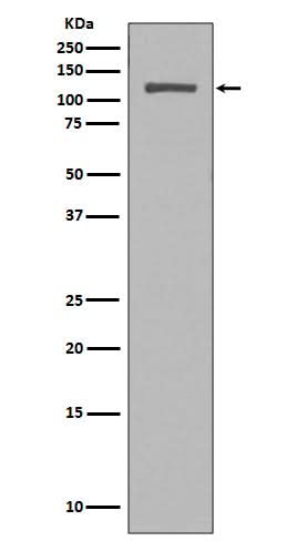 Anti-NUP98 Rabbit Monoclonal Antibody Boster Bio