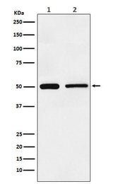 Anti-TIM1 HAVCR1 Monoclonal Antibody Boster Bio