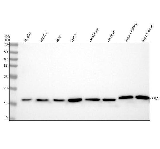 Anti-Cyclophilin A PPIA Rabbit Monoclonal Antibody Boster Bio