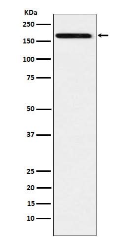 Anti-IL17A Receptor Rabbit Monoclonal Antibody Boster Bio