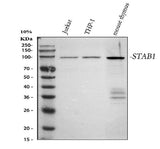 Anti-SATB1 Rabbit Monoclonal Antibody Boster Bio