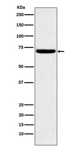 Anti-Heparanase 1 HPSE Monoclonal Antibody Boster Bio