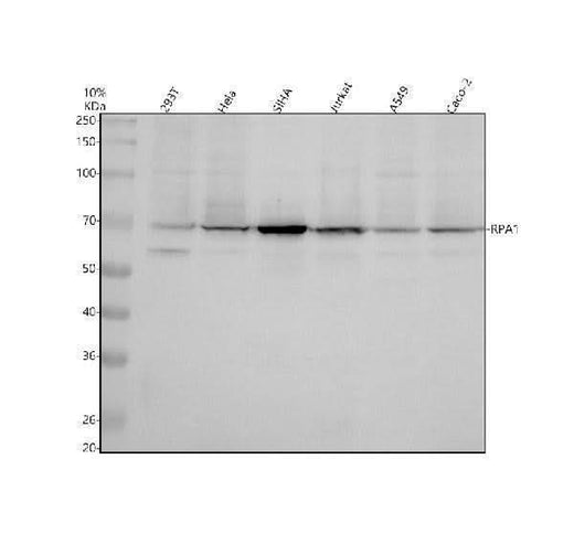 Anti-RPA70 Monoclonal Antibody Boster Bio