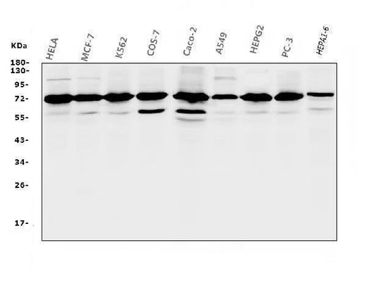 Anti-RPA70 RPA1 Antibody Picoband® (monoclonal, 11H4 Boster Bio