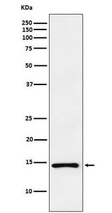 Anti-ANP NPPA Monoclonal Antibody Boster Bio