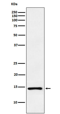 Anti-ANP NPPA Monoclonal Antibody Boster Bio