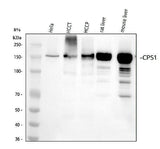 Anti-CPS1 Monoclonal Antibody Boster Bio