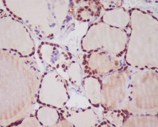 Anti-TTF1 NKX2-1 Rabbit Monoclonal Antibody Boster Bio