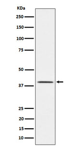 Anti-TTF1 Rabbit Monoclonal Antibody Boster Bio