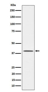 Anti-TTF1 Rabbit Monoclonal Antibody Boster Bio