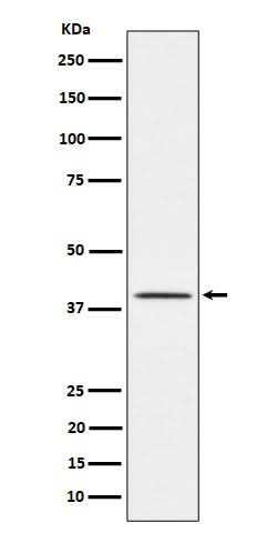 Anti-TTF1 Rabbit Monoclonal Antibody Boster Bio